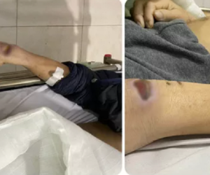 Hai cựu công an dùng nhục hình thế nào khiến người bị tạm giam tử vong?
