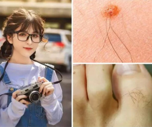 3 điểm càng nhiều lông càng phát lộc thịnh vượng hơn người
