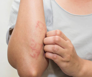 Ngứa ở 7 vị trí là dấu hiệu cảnh báo cơ thể có khối u ác tính, dù chỉ có 1 cũng nên đi khám ngay