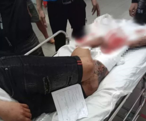CLIP: Tài xế bị nhóm côn đồ chặn xe chém dã man