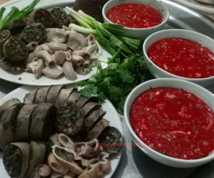 Khối u chiếm gần hết ruột vì thói quen ăn, uống nhiều người mắc