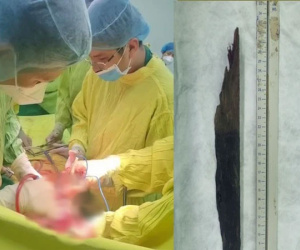Tránh chó lao ra đường, thiếu niên 17 tuổi gặp tai nạn thương tâm