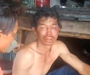Vụ ngư dân bị hành hạ bằng kìm: Khởi tố, bắt giam 3 bị can