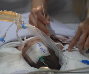 Bé trai vừa chào đời đã đối mặt với nguy cơ tử vong vì khối bướu khổng lồ hiếm gặp