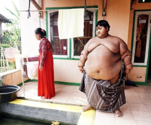 Màn 'lột xác' khó tin của cậu bé béo nhất thế giới