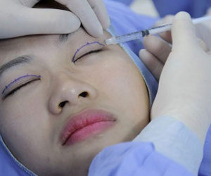Người phụ nữ suốt ba năm 'trợn mắt' vì cắt mí