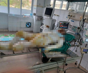 Vụ 3 con gái mang xăng đốt nhà mẹ đẻ ở Hưng Yên: Người mẹ đã 2 lần ghép da nhưng rất yếu