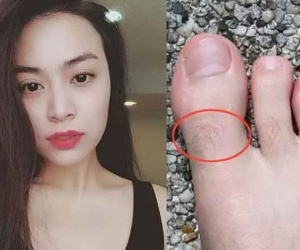 Xấu xấu chướng mắt nhưng lông mọc nhiều ở 4 vị trí này thì trời định giàu sang, lộc không cản nổi