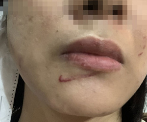 Phó trưởng công an xã đánh vợ cũ nhập viện