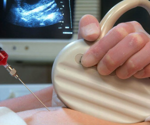 Mẹ bầu 4 tháng chọc ối xét nghiệm ADN nhận kết quả choáng váng: Thai nhi là con bố, không phải con mẹ