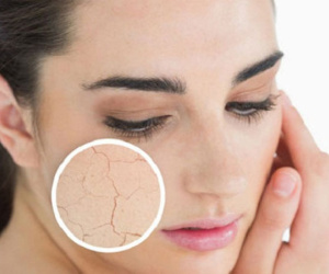 6 sai lầm khiến da nứt nẻ, gây ngứa vào ngày lạnh