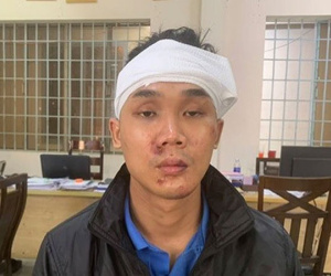 Ảnh minh họa