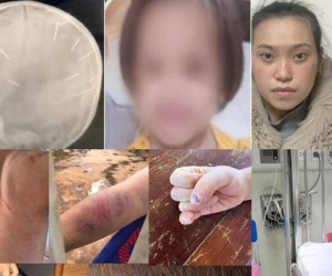 Sát hại con, đánh cháu... buồn lòng những vụ bạo hành trẻ em năm 2022
