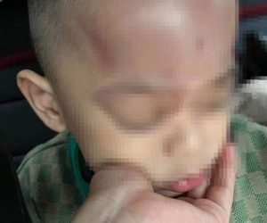 Xác minh thông tin trẻ bị bạo hành ở trường mầm non tại Đà Nẵng