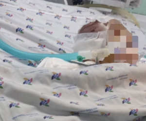 Bé 6 tháng tuổi phù não nguy kịch, nghi bị bạo hành ở nhà trẻ