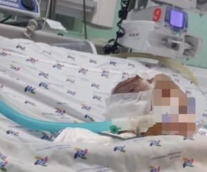 Vụ bé 6 tháng tuổi bị đánh dập não: Nạn nhân thương tích 99%