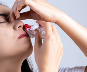Nhiều người chảy máu cam mùa đông, dấu hiệu nào nên đi viện ngay?
