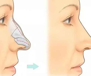 4 nét tướng của gái 'ế bền vững' duyên đến lại đi, xinh đẹp đến mấy cũng vô dụng