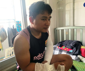Giao hàng không nhận, cặp vợ chồng ở Quảng Ngãi đánh shipper gãy 2 tay