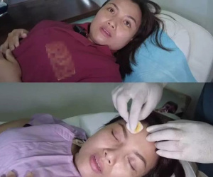 Ảnh cận nhan sắc Quỳnh Trần JP sau hơn 1 tuần chi khủng 'dao kéo'