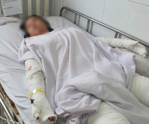 Cha mẹ bỏng nặng, con gái tử vong vì nướng mực bằng cồn sát khuẩn