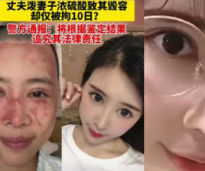 Tạt axit vào mặt vợ vì người phụ nữ đòi ly hôn, chồng chỉ bị tuyên 10 ngày giam giữ và hơn 1 triệu tiền phạt