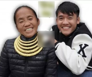 Bất ngờ diện mạo Bà Tân Vlog sau 4 tháng phẫu thuật thẩm mỹ