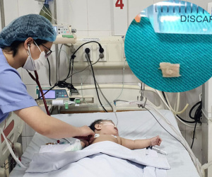 Bé gái 10 tháng tuổi suy hô hấp, phải thở máy vì hóc mía