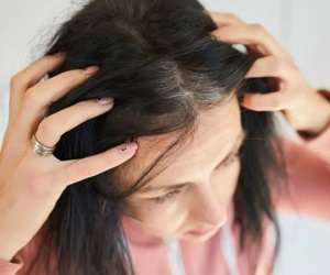 Tại sao chỉ sau một đêm có người bạc trắng đầu?