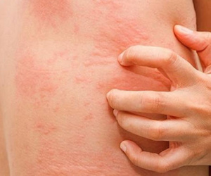 Ngứa 2 vị trí này báo hiệu gan đang kêu cứu, vị trí thứ nhất nhiều người làm tưởng bệnh ngoài da