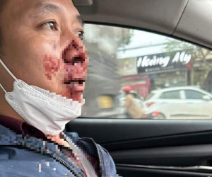 Táo tợn chặn ôtô của thầy giáo cướp tài sản giữa ban ngày