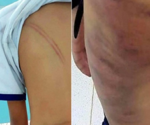 Rơi nước mắt chuyện những đứa trẻ bị bố và mẹ kế hành hạ dã man