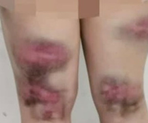 Bị mẹ vác gậy đánh bầm tím cả người vì 30 tuổi chưa có người yêu và cái kết gây sốc