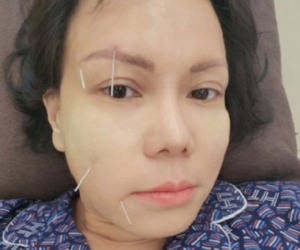 Từ vụ Việt Hương bị méo mặt, bác sĩ chỉ ra thói quen gây bệnh nhiều người mắc phải