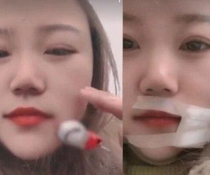 Người vợ bị chồng quăng móc câu trúng má khi đang đi câu cá với nhau