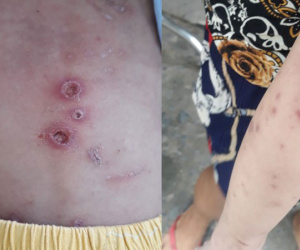 Vụ bé trai nghi bị bạo hành: Nạn nhân đa chấn thương, xuất huyết não, tình trạng bé còn nặng
