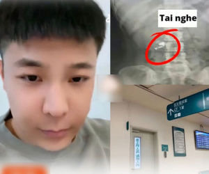 Đắng lòng thanh niên nửa đêm nuốt nhầm tai nghe bluetooth, chạy tới bệnh viện bật nhạc điện thoại lên bụng còn phát ra âm thanh xập xình khiến bác sĩ ngã ngửa