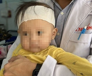 Bé 10 tháng tuổi nguy kịch sau khi ăn cháo lươn: Nằm viện 3 tháng, tốn 100 triệu đồng
