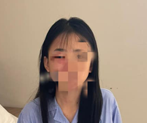 Nữ sinh lớp 8 ở Hà Nội bị đánh hội đồng phải nhập viện: Công an vào cuộc điều tra