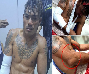 Bị cao thủ Thái Lan đánh gãy tay, võ sĩ số 1 Campuchia đau đớn xin hàng