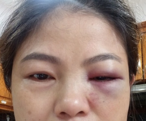 Đồng Nai: 4 mẹ con cầu cứu công an vì bị bạo hành
