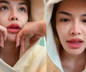 Mới đăng quang một ngày, Hoa hậu lộ mặt mộc 'gây sốc', cằm lệch một bên khác xa ảnh đăng tải