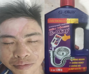 CẢNH BÁO: Nhiều người bỏng nặng khi dùng nước thông cống siêu tốc