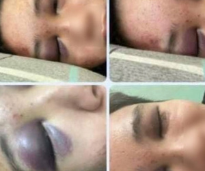 Nam sinh lớp 10 ở TP.HCM bị bạn đánh nhập viện