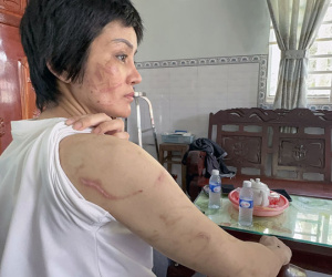 Thông tin nóng vụ vợ mang bầu 7 tháng 'tố' chồng trói tay chân, đánh đập dã man