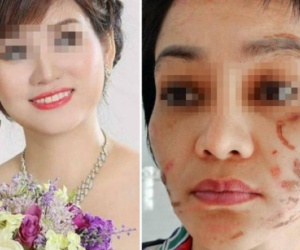 Vụ chồng đánh vợ mang bầu 7 tháng dã man: Người chồng nói chỉ đánh vợ bằng dây thắt lưng