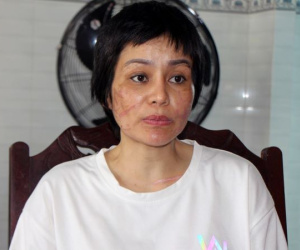 Đề nghị đảm bảo an toàn cho người phụ nữ bị chồng bạo hành