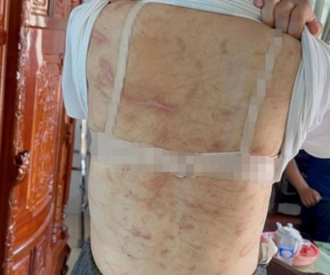 Vụ vợ mang thai 7 tháng bị chồng bạo hành như thời trung cổ: Người chồng có thể bị xử lý thế nào?