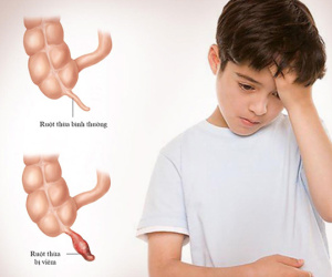 Bé 8 tuổi phải mổ cấp cứu vì gia đình mải đi du lịch
