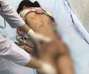 Ảnh bìa bài viết 880919